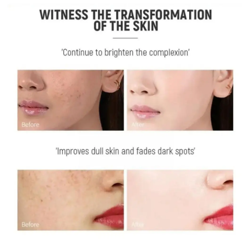 Effective Whiten Freckle Cream Brighten Face Remove Dark Face Spot