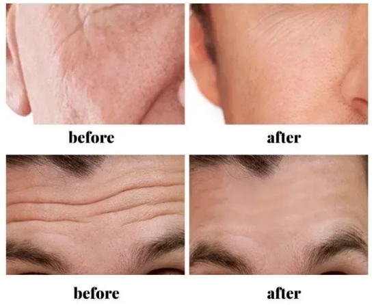 Collagen Creams For Men Anti Wrinkle Anti Aging Face Cream Firming