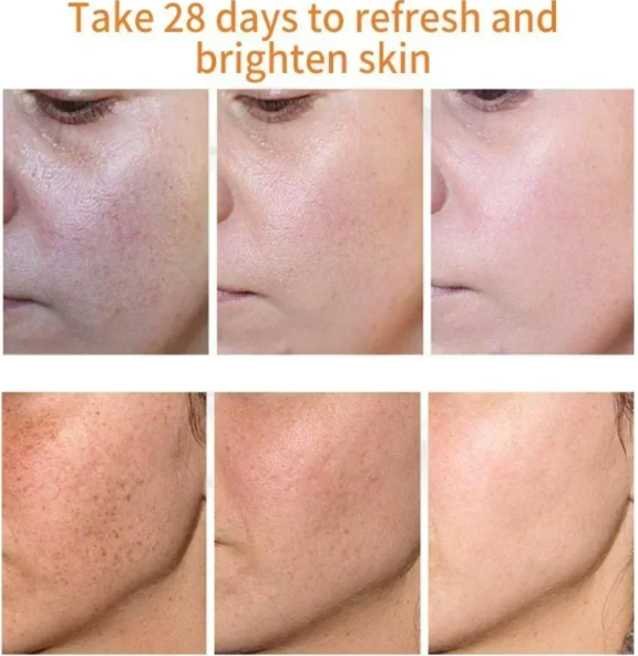 Effective Whiten Freckle Cream Brighten Face Remove Dark Face Spot